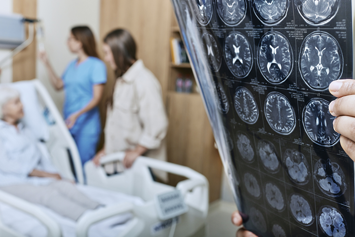 Primary Care Stroke: Prevention, Recognition, and Long-Term Care 1 Doctor reviewing brain imaging for stroke patient in Fairfax