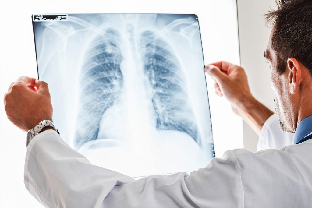 Concierge Care norvinia pneumonia 02