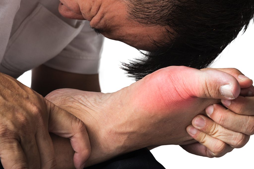 Concierge Care norvinia gout symptoms 02
